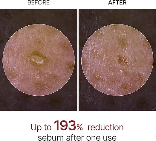 Dr. Melaxin White Rice Exfoliating Gel – Removes Dead Skin & Blackheads, 80ml
